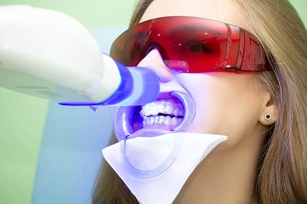 Laser teeth whitening treatments Hampshire