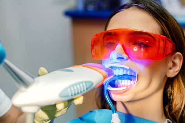 Simplifying Teeth Whitening: A Comprehensive Guide Hampshire