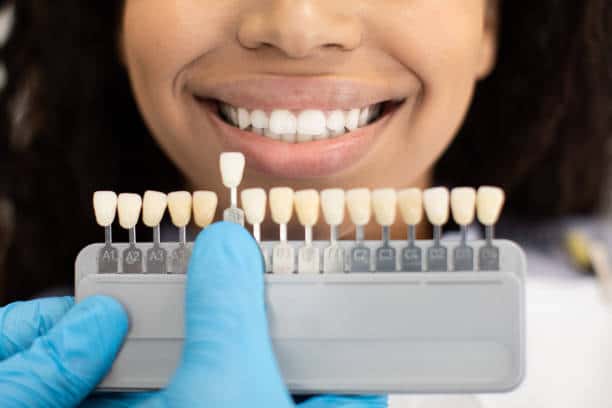 Laser Teeth Whitening: Exploring the Longevity of Your Brighter Smile Hampshire