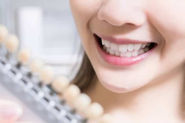 Teeth Whitening Kings Norton Hampshire