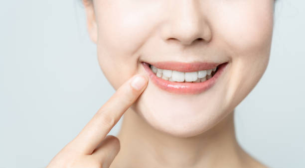 Comparing the Pain Factor: Laser Teeth Whitening vs. Zoom Teeth Whitening Hampshire