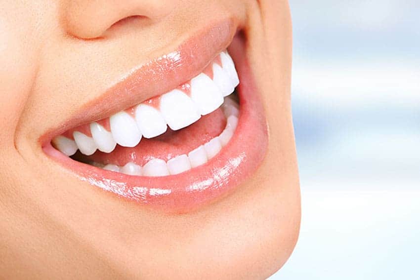 Teeth Whitening Abingdon Hampshire