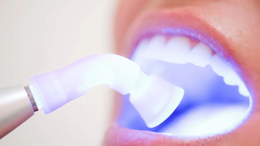 Teeth Whitening Aylesbury Hampshire